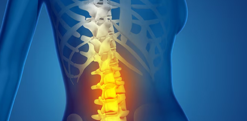 Spine Surgery 