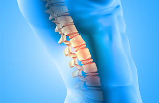  Spine surgery
