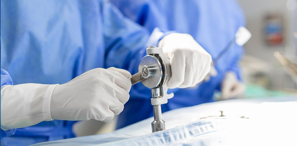  Arthroscopy